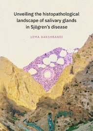 Unveiling the histopathological landscape of salivary glands in Sjögren’s disease