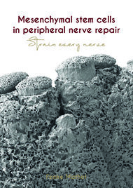 Mesenchymal Stem Cells in peripheral nerve repair