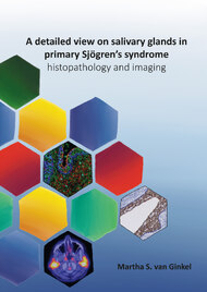 A detailed view on salivary glands in primary Sjögren’s syndrome